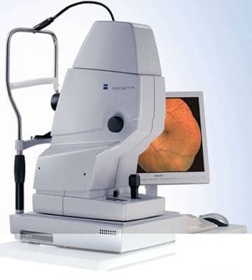 retinal Imaging - oct - ffa - icg
